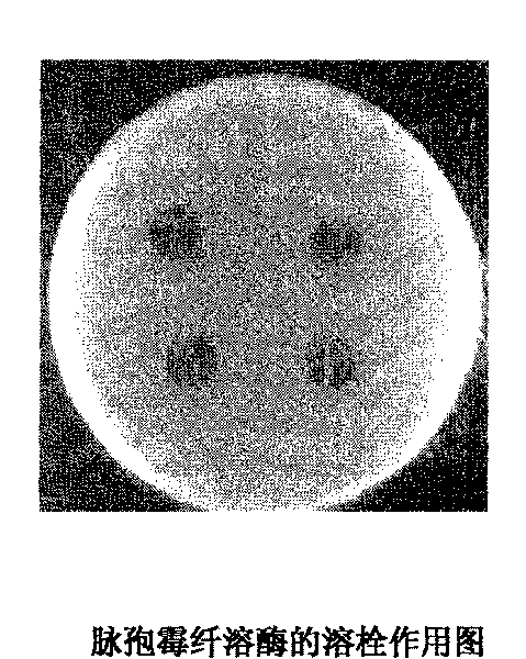 Plasmin cultivation method