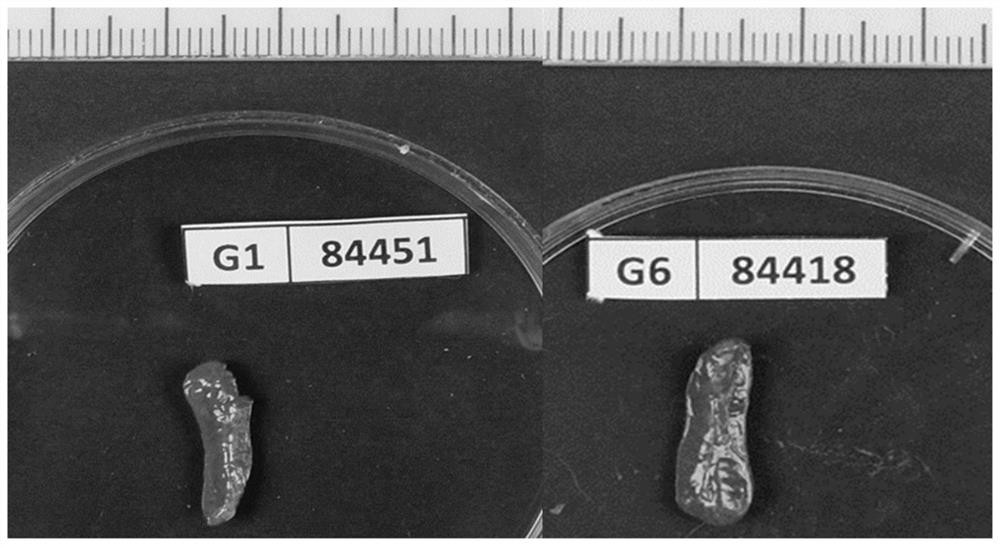 Application of CTLA4 gene and PD1 gene humanized mouse model