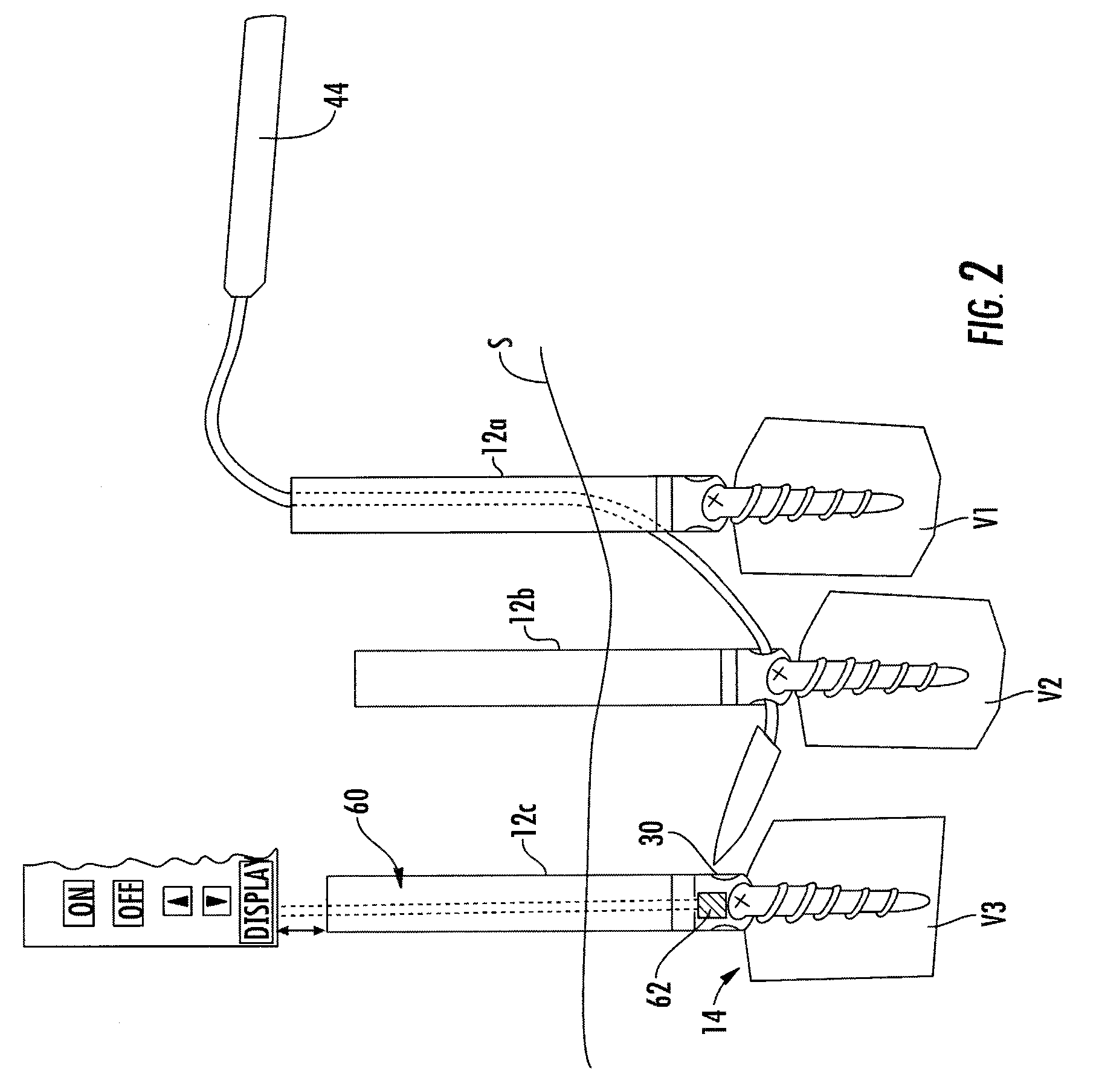 Magnetic targeting system for facilitating navigation