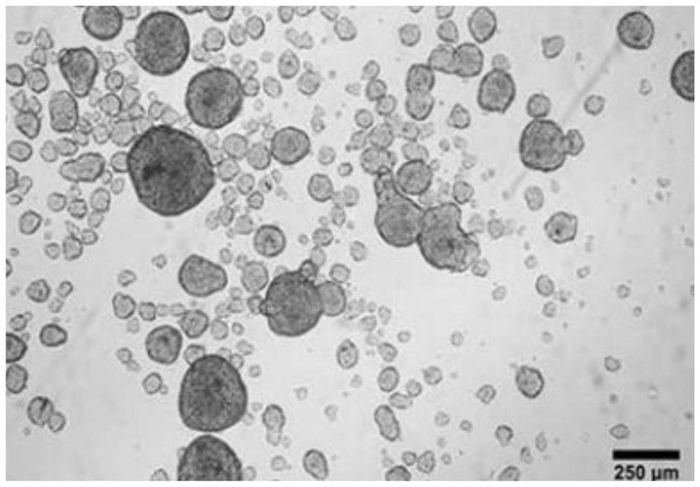 Autologous hair growth matrix stem cell culture method for cerebral hemorrhage sequelae of premature infant