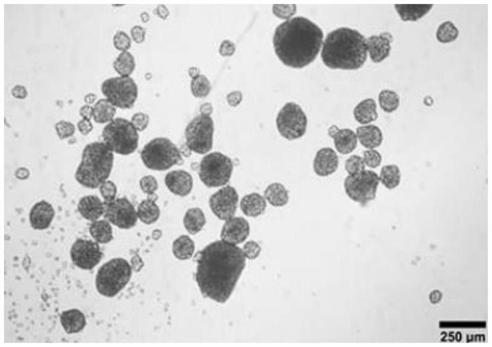 Autologous hair growth matrix stem cell culture method for cerebral hemorrhage sequelae of premature infant