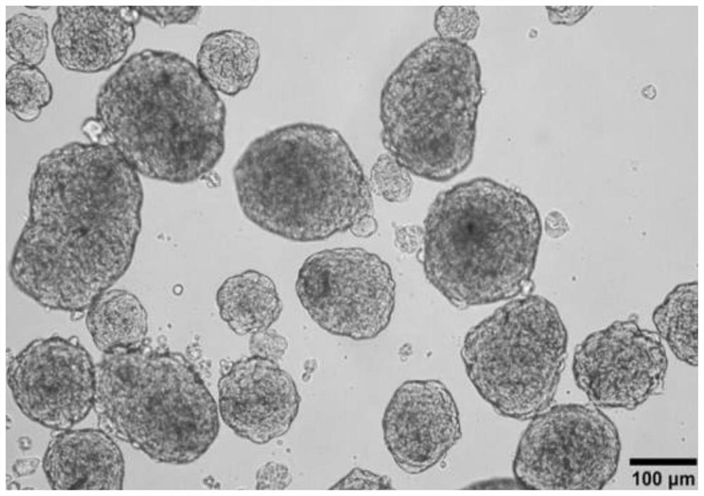 Autologous hair growth matrix stem cell culture method for cerebral hemorrhage sequelae of premature infant