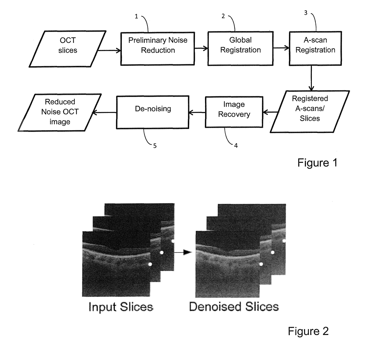 Reducing speckle noise in optical coherence tomography images