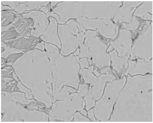 A kind of mixed hyaluronic acid gel and preparation method thereof