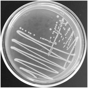 Application of complex microbial inoculant containing bile acid in preparation of preparation for preventing and treating fatty liver of pets