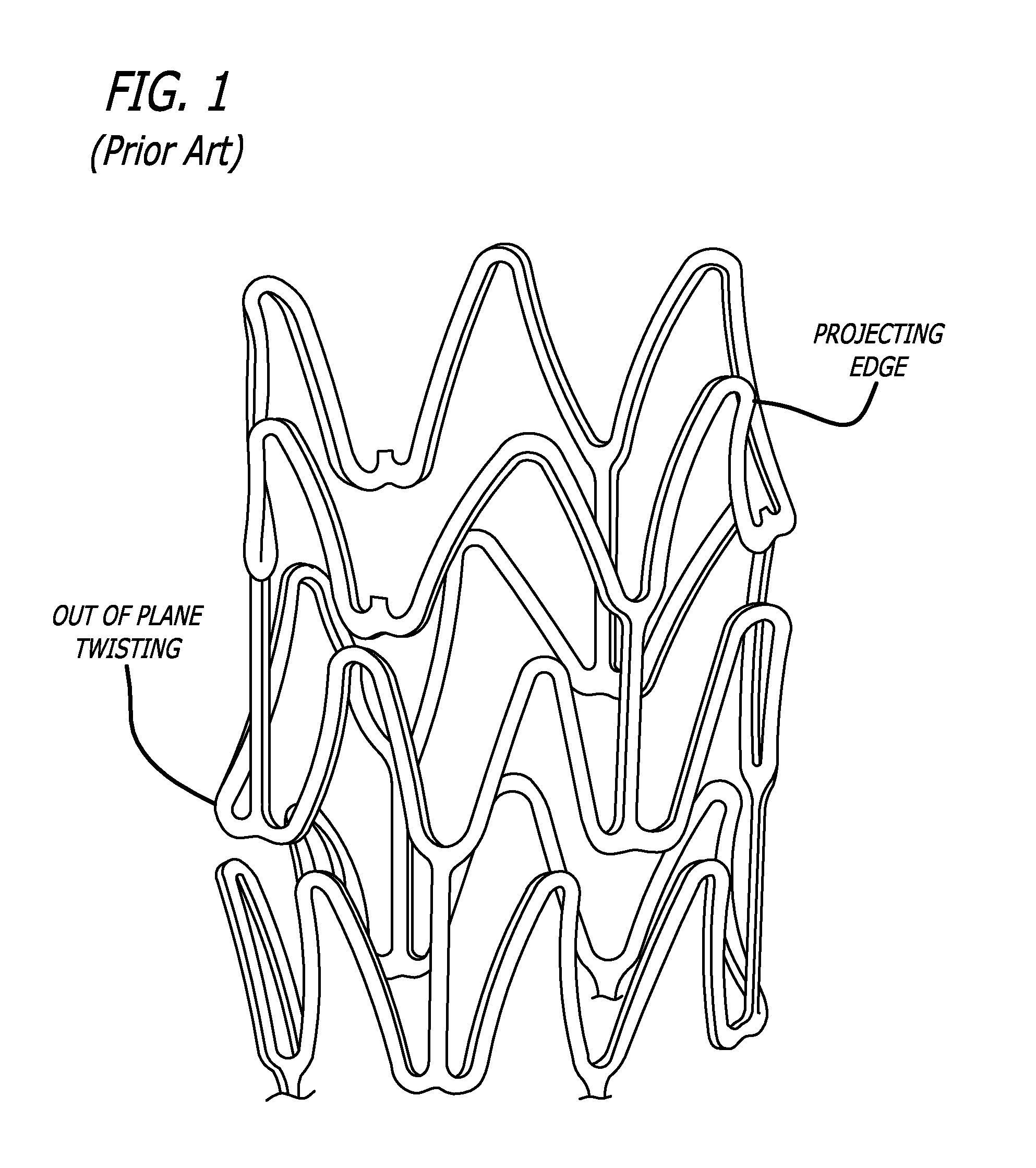 Stent having optimized expansion ratio