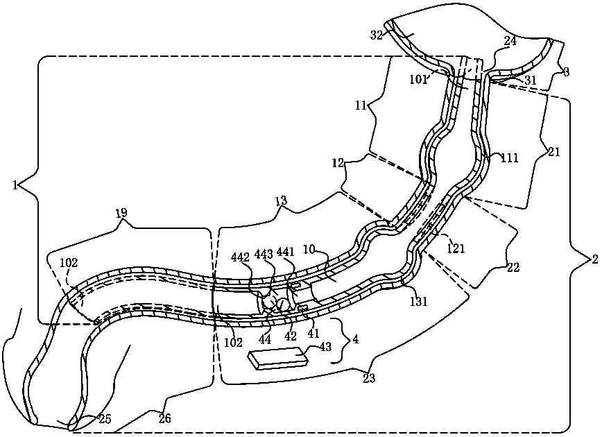 Built-in catheter