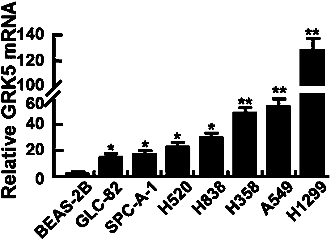 Application of human GRK5 genes