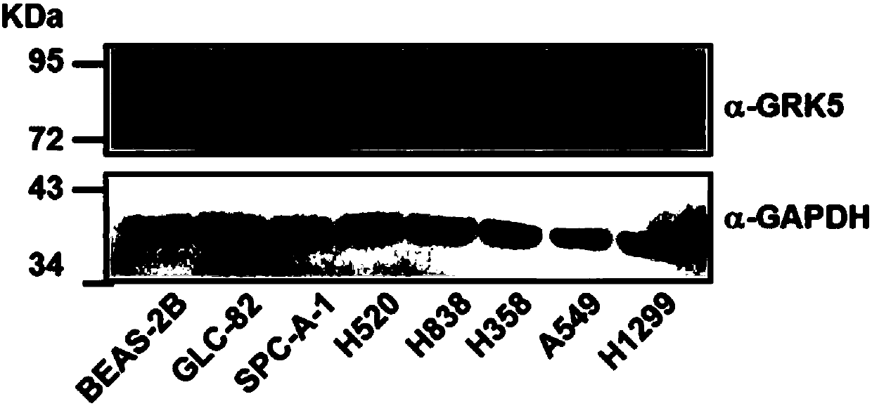 Application of human GRK5 genes