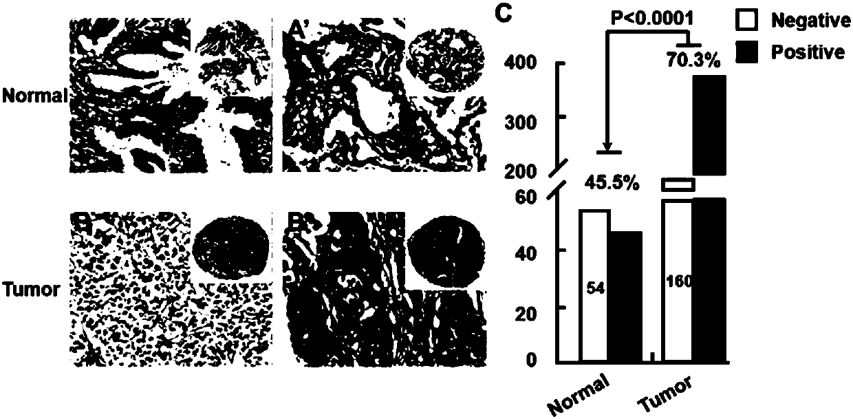 Application of human GRK5 genes