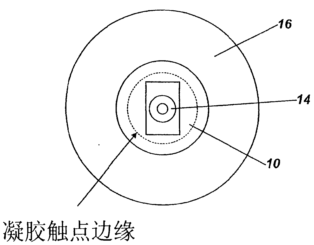 Electrode and electrode positioning arrangement for abdominal fetal electrocardiogram detection