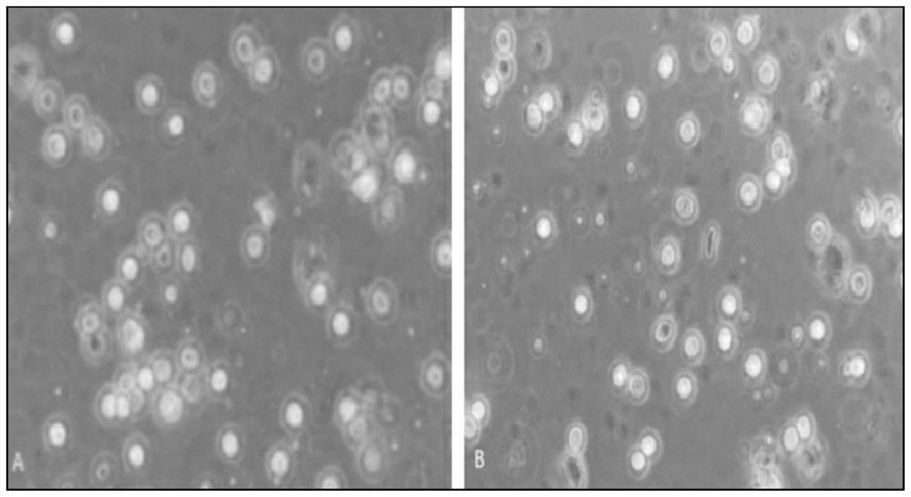 A kind of preparation method of placental hematopoietic stem cell