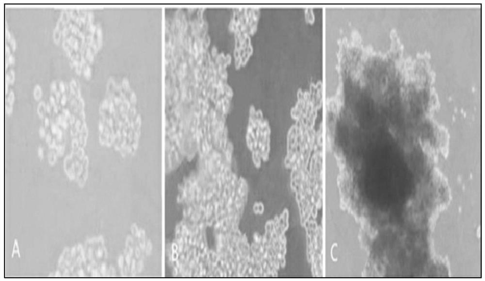 A kind of preparation method of placental hematopoietic stem cell