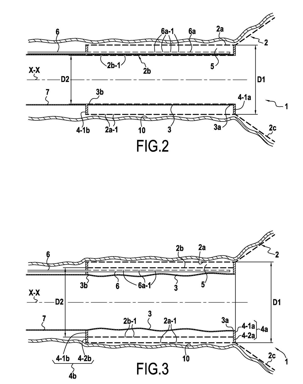 Surgical device for controlled anchoring in the intestine