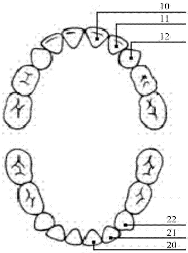 Auxiliary tooth socket applicable to mixed dentition period and manufacturing method