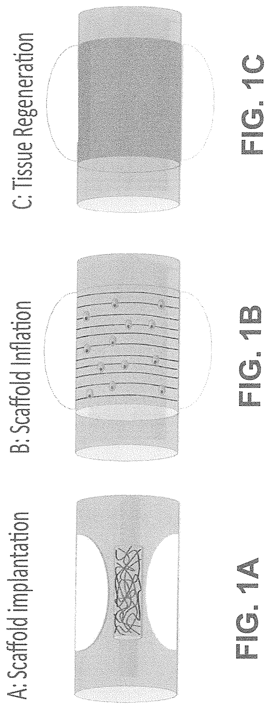 Fibrous tubular conduit for stenting applications