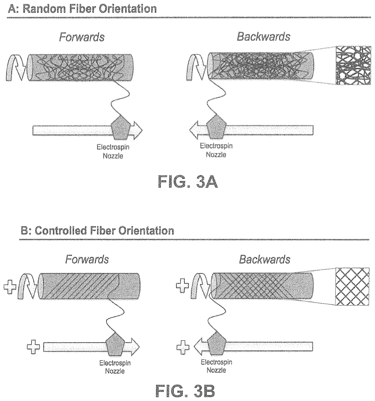 Fibrous tubular conduit for stenting applications