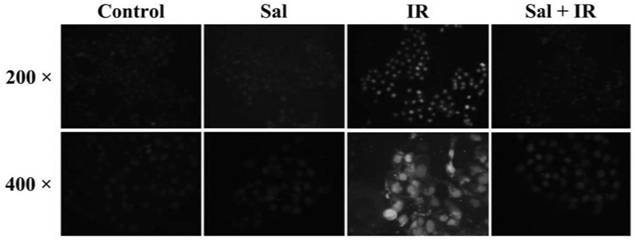 Application of Salidroside in Preventing Radiation Injury of Salivary Gland