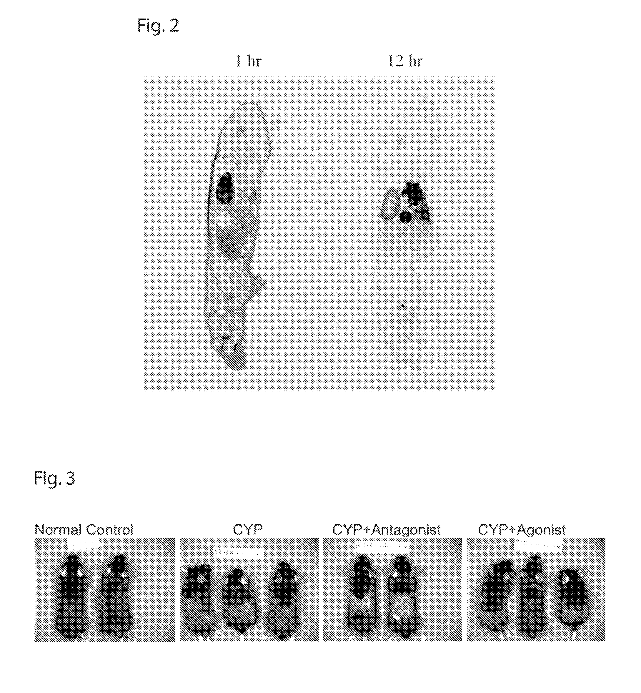 Delivery of therapeutic agents by a collagen binding protein