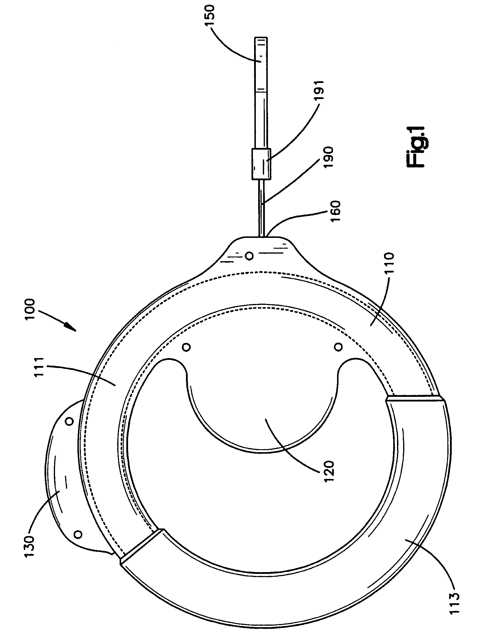 Ring-shaped retractable pet lead