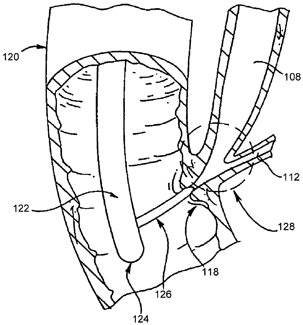 Endoscopic ultrasound-guided biliary access system