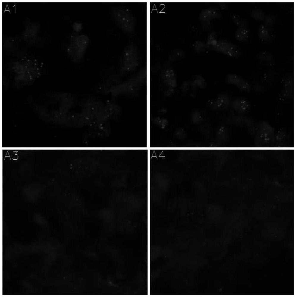 Probe set for detecting amplification level of HER2 gene and application of probe set