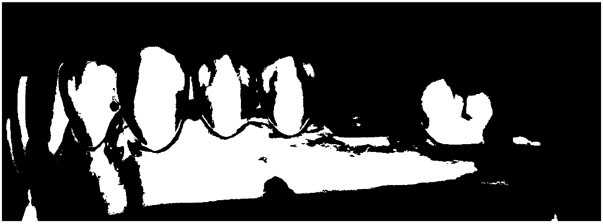 Design method, system and device of prosthodontic body and readable storage medium