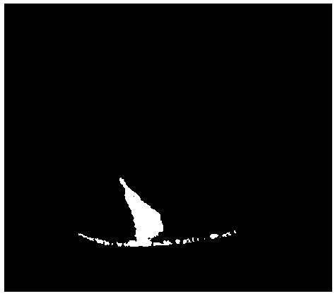 Design method, system and device of prosthodontic body and readable storage medium