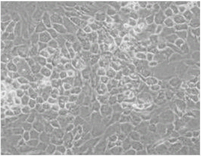 Method for quickly and efficiently separating cartilage cells