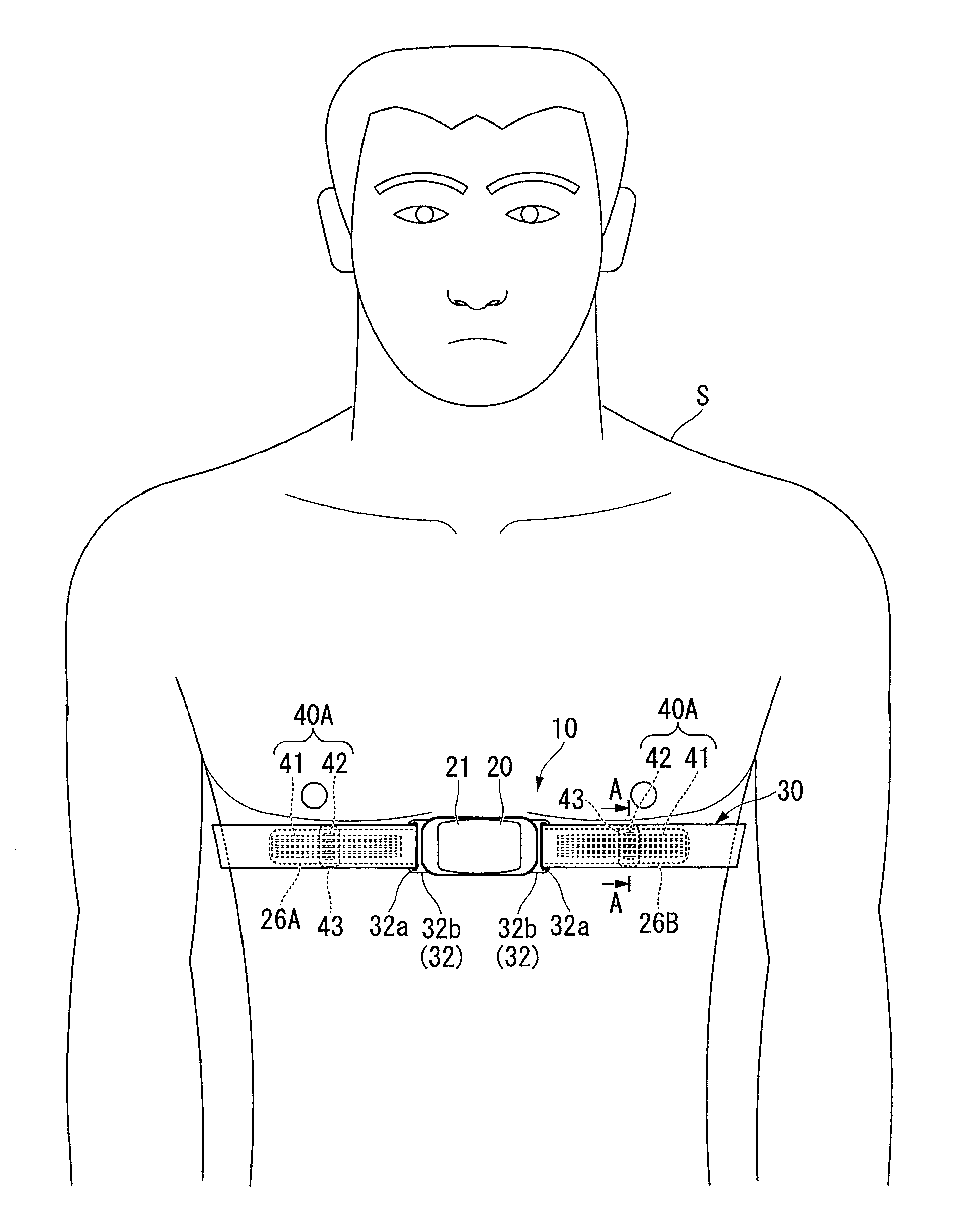 Biological information detecting device