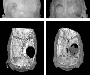 Photo-cured degradable polyester composite guided bone regeneration membrane