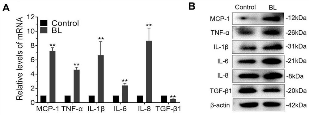 Application of thrombospondin 1 (THBS-1) in preparation of medicine for preventing and/or treating age-related macular degeneration (AMD)