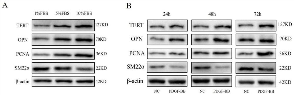 Application of reagent for inhibiting TERT expression in preparation of medicine for preventing or treating thoracic aortic aneurysm