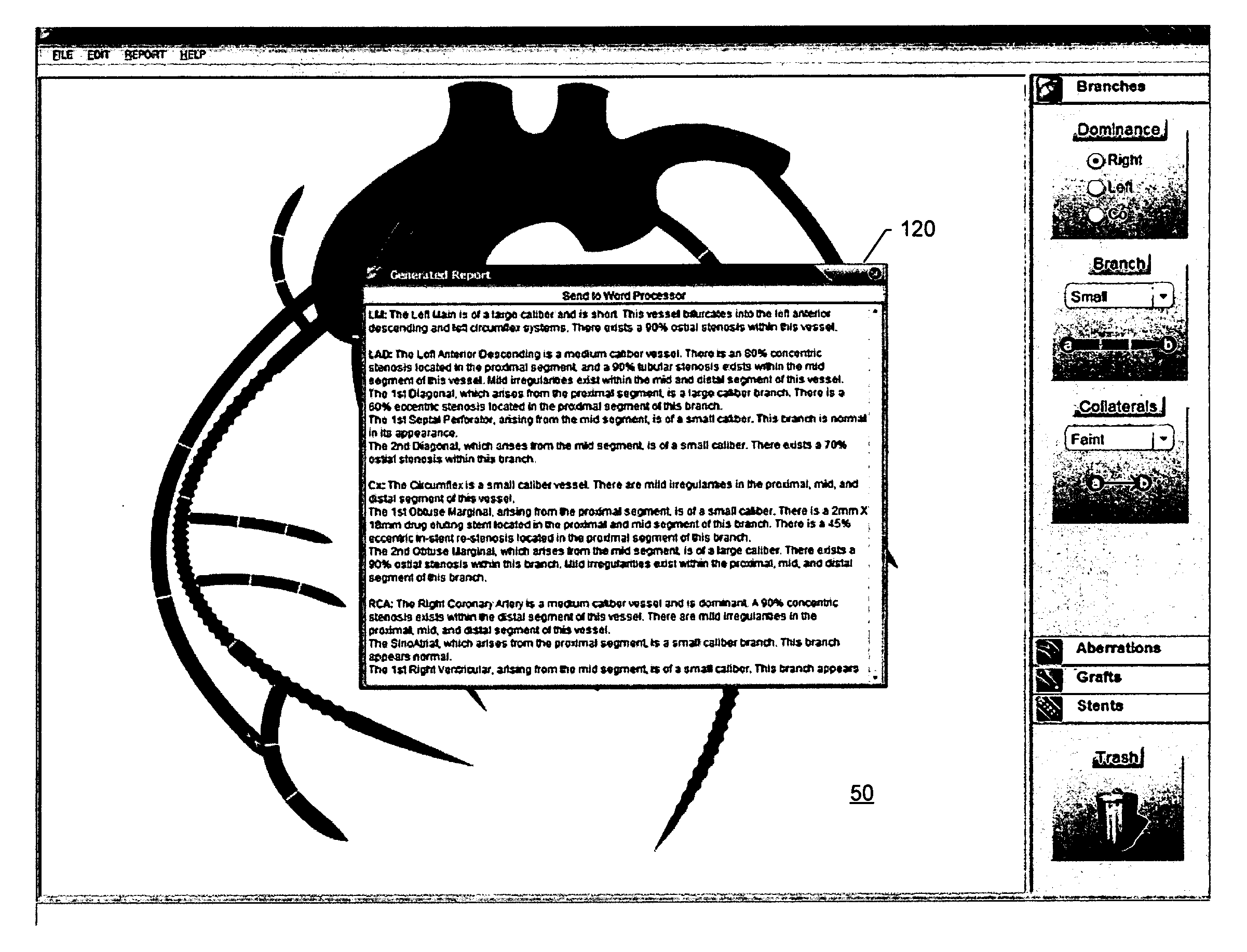 System, method and computer program product for graphically illustrating entities and generating a text-based report therefrom