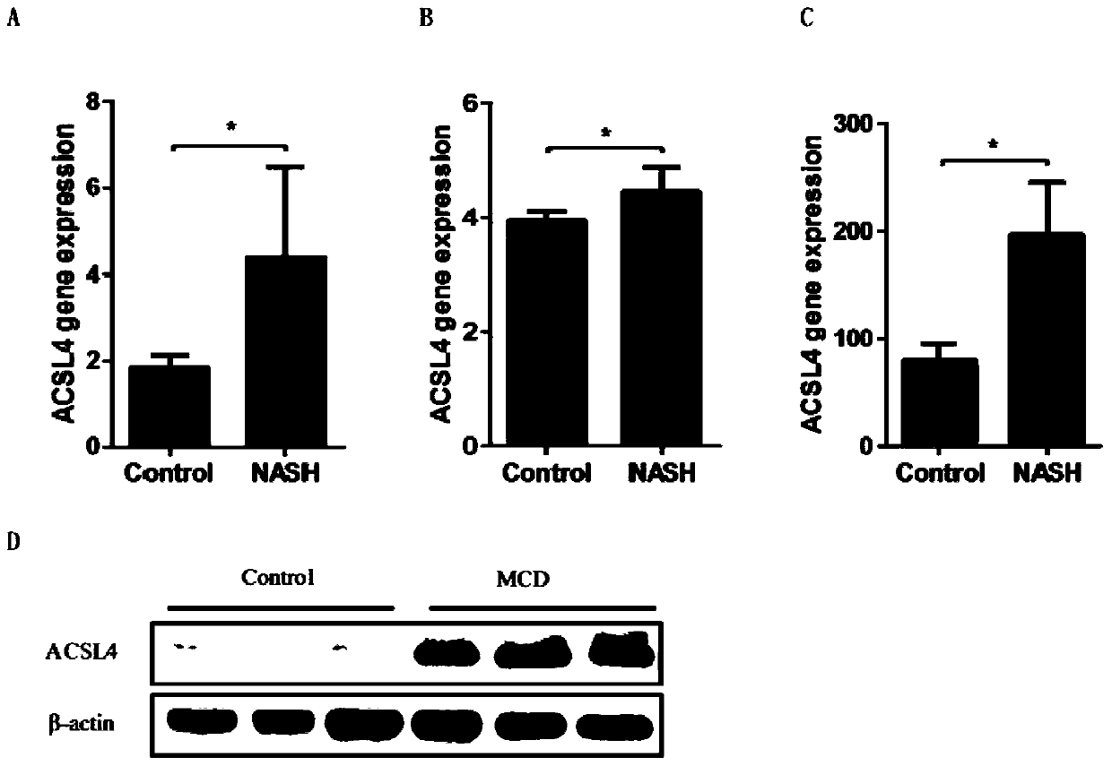 ACSL4 and application thereof in NASH