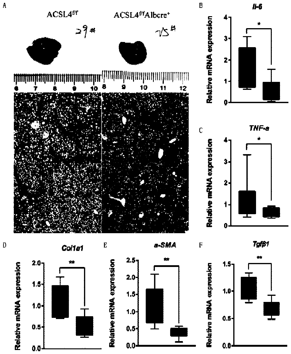 ACSL4 and application thereof in NASH