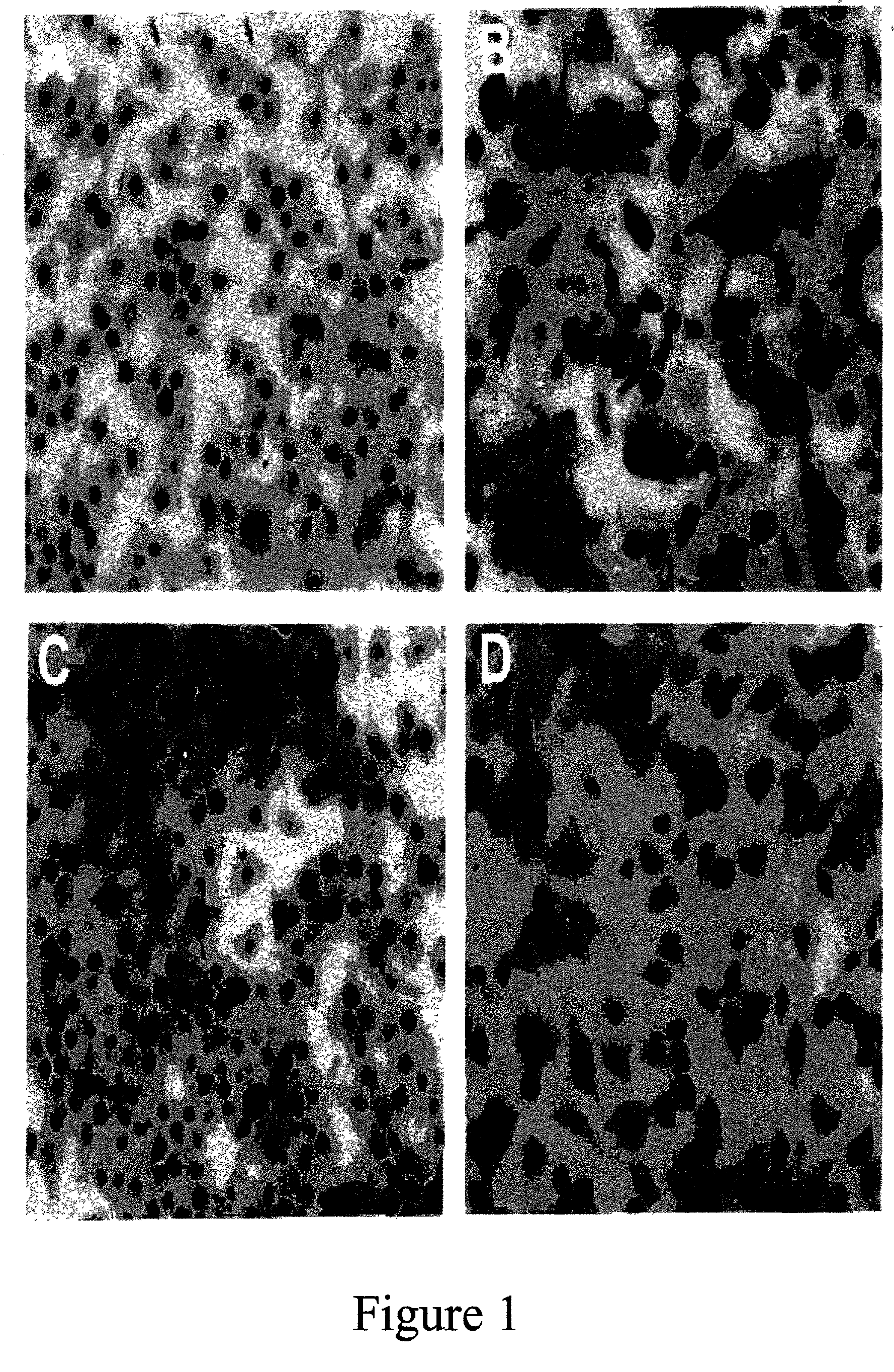 Pharmaceutical composition useful for inhibition of osteoclast formation and a process for the extraction of mussel hudrolysate from indian green mussel