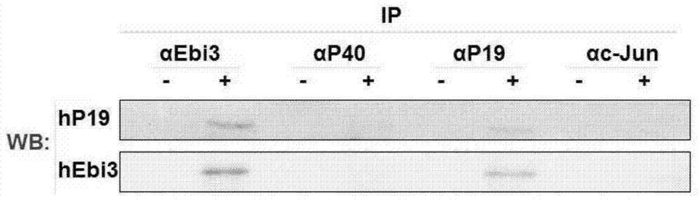 Application of p19/ebi3 complex and its polyclonal antibody in the diagnosis and treatment of systemic lupus erythematosus