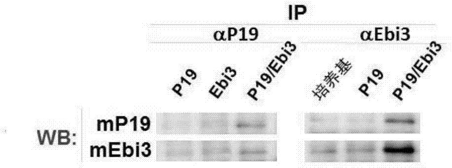 Application of p19/ebi3 complex and its polyclonal antibody in the diagnosis and treatment of systemic lupus erythematosus