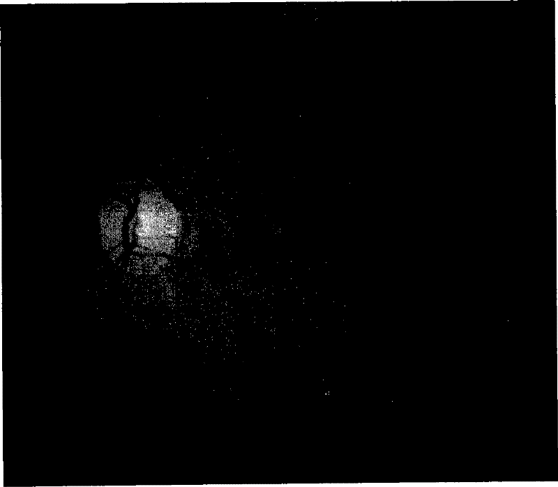 Ocular fundus image registration method estimated based on distance transformation parameter and rigid transformation parameter