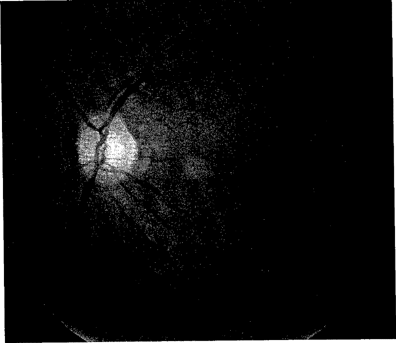 Ocular fundus image registration method estimated based on distance transformation parameter and rigid transformation parameter