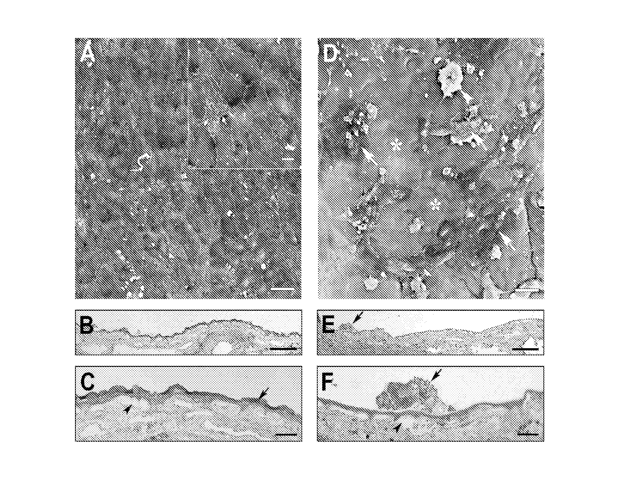 Method of using an extracellular matrix to enhance cell transplant survival and differentiation