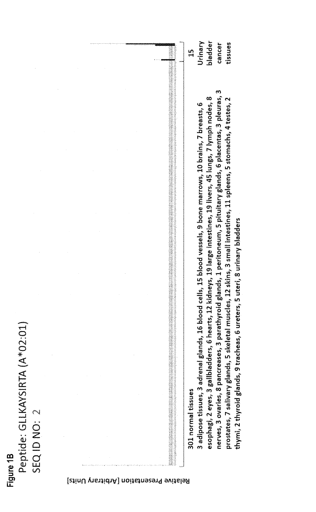 Peptides, combination of peptides, and cell based medicaments for use in immunotherapy against urinary bladder cancer and other cancers