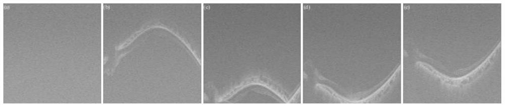 Method for performing fundus refractive compensation judgment and imaging optimization by using OCT signal