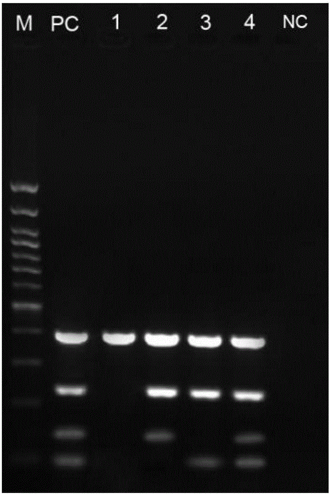 Rapid detection kit and method for legionella pneumophila ST1 strain