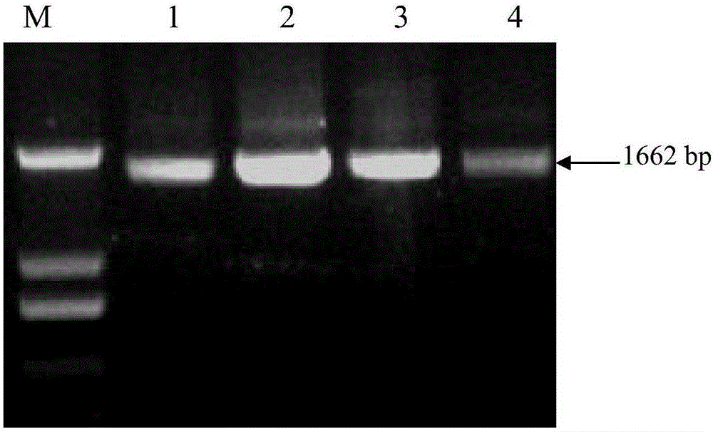 Soybean mosaic virus resistant gene GmNN1 and application of functional markers of soybean mosaic virus resistant gene GmNN1