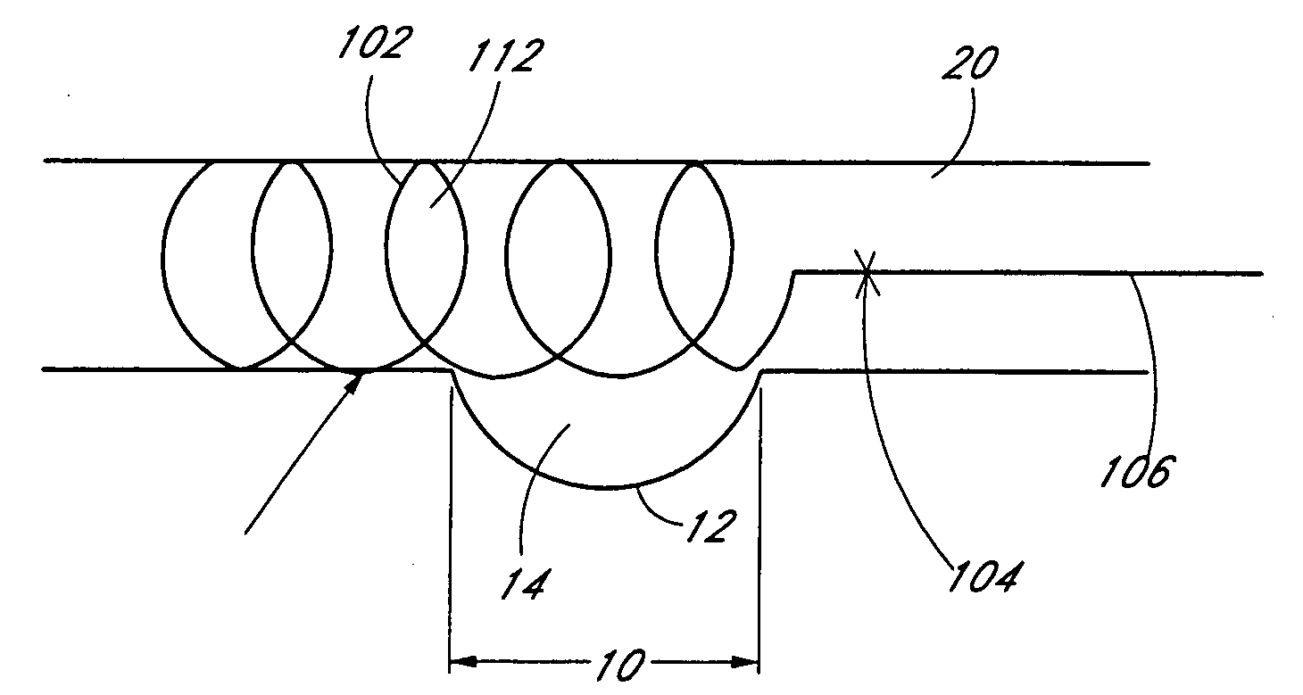 Dynamically adjustable vascular stent