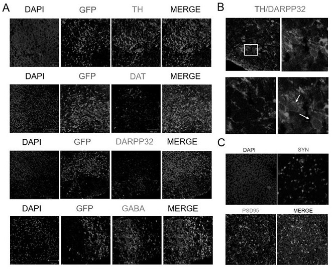 Neural organoid and preparation method thereof