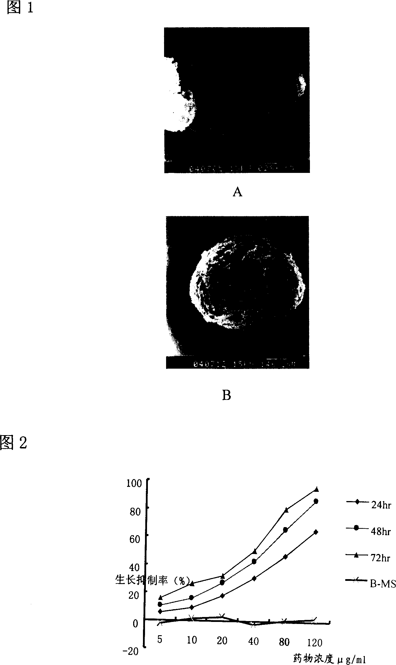 Tumour interposition suppository norcantharidin-alginic acid/poly-acid anhydride control-release microsphere