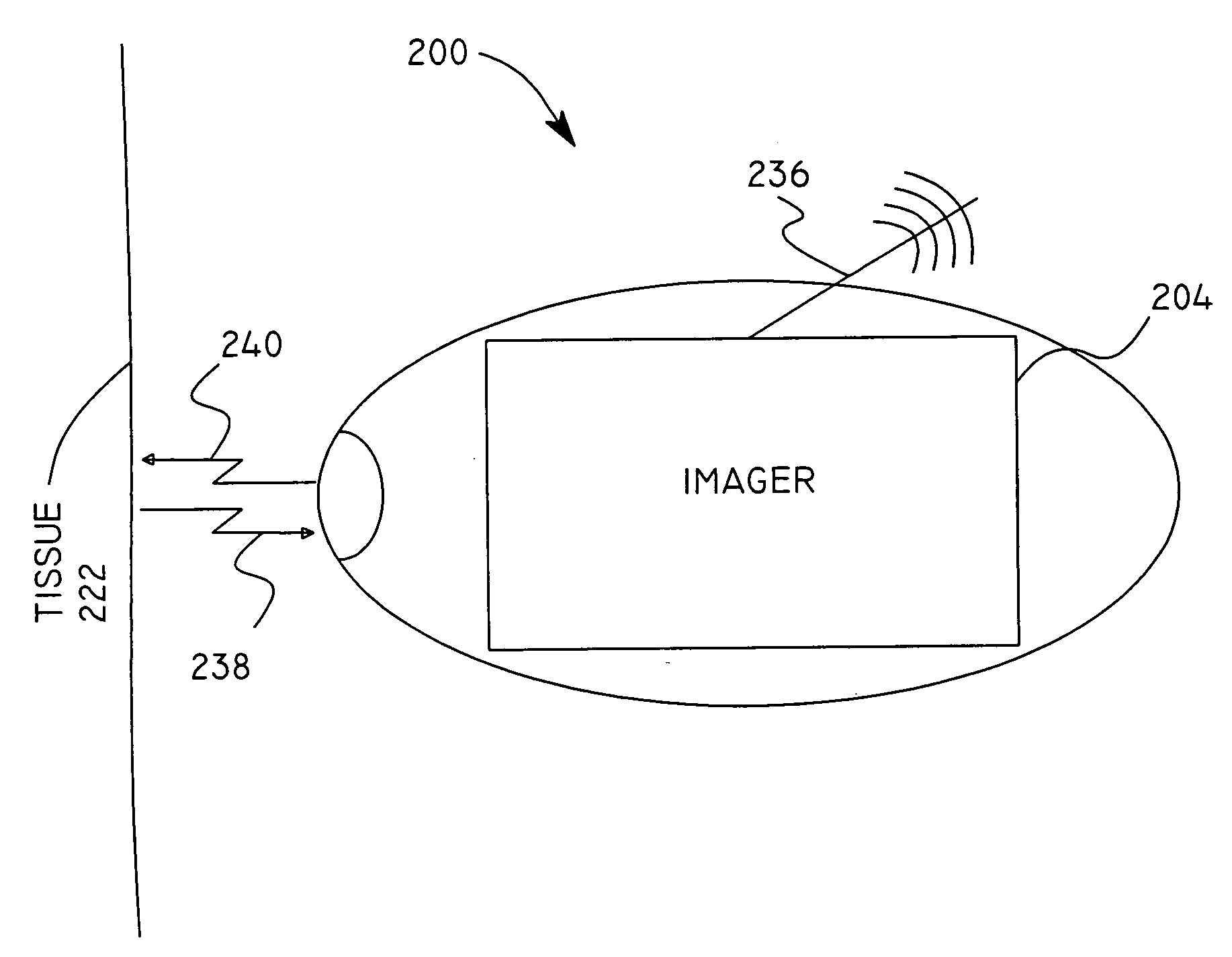 Micro-scale compact device for in vivo medical diagnosis combining optical imaging and point fluorescence spectroscopy